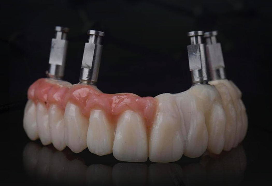 חומרי מעבדת שיניים